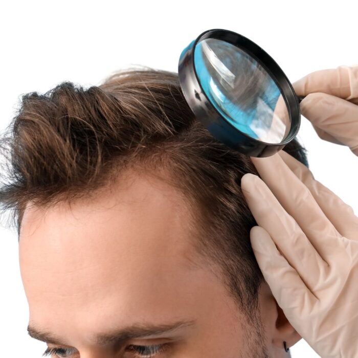Greffe de Cheveux - Forfait DHI
